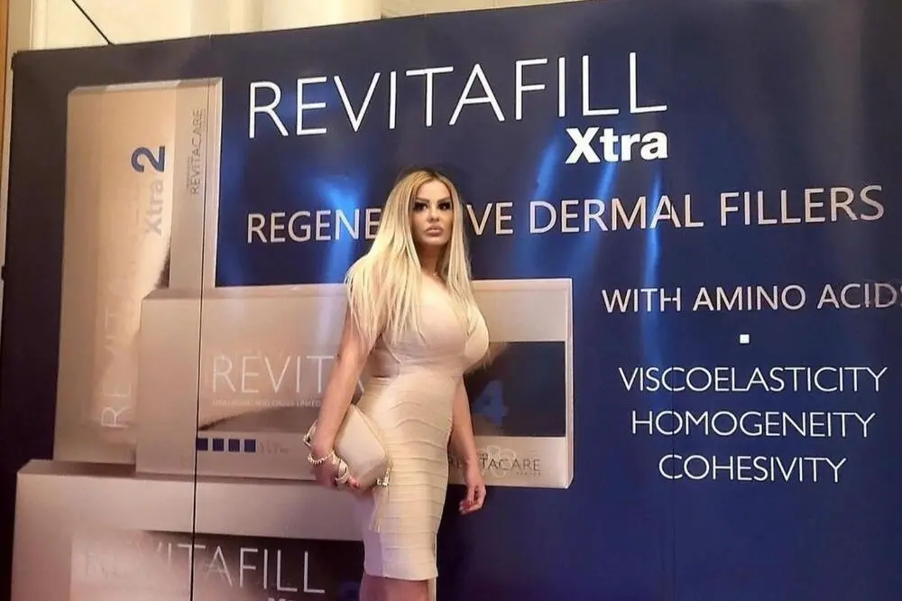 1489365 3831490 viberslika20240305145514193 ls ls