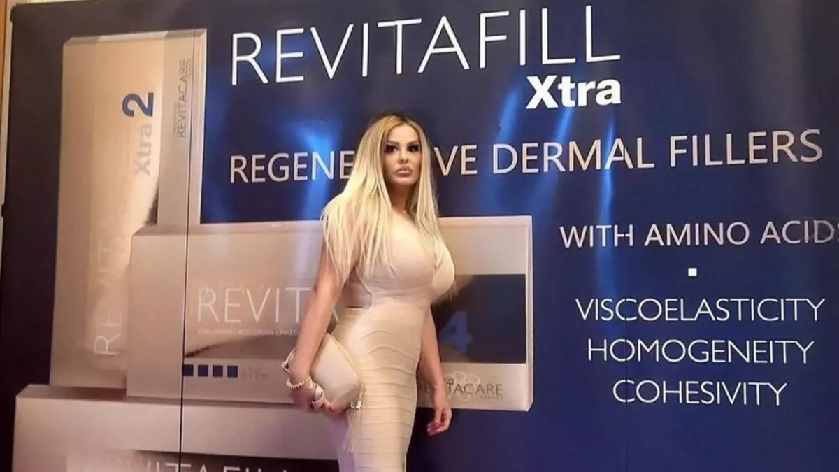 1489365 3831490 viberslika20240305145514193 ls ls